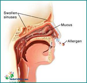 Nasal Mucus Plug Causes Symptoms and Treatment