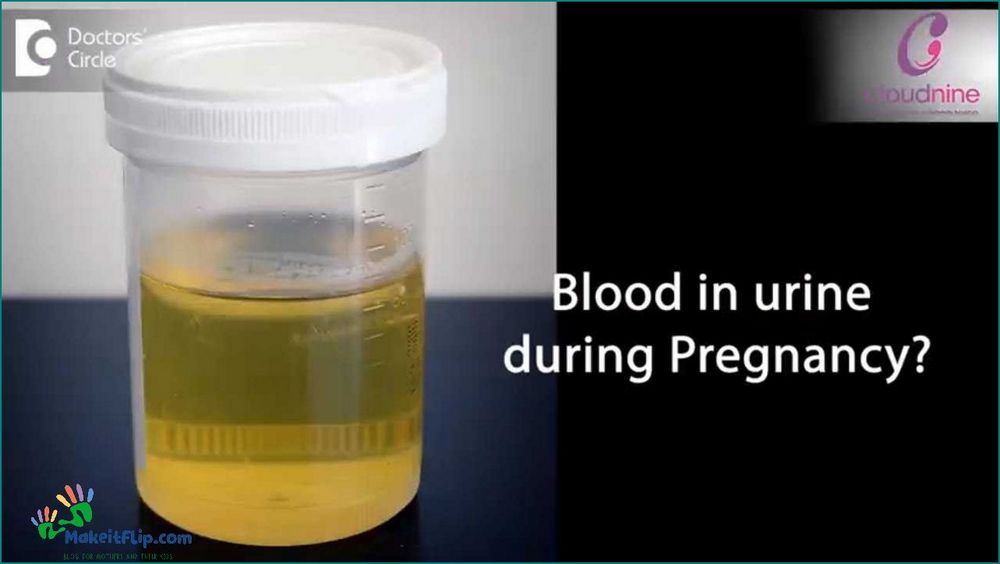 Blood in Urine During Pregnancy Causes Symptoms and Treatment