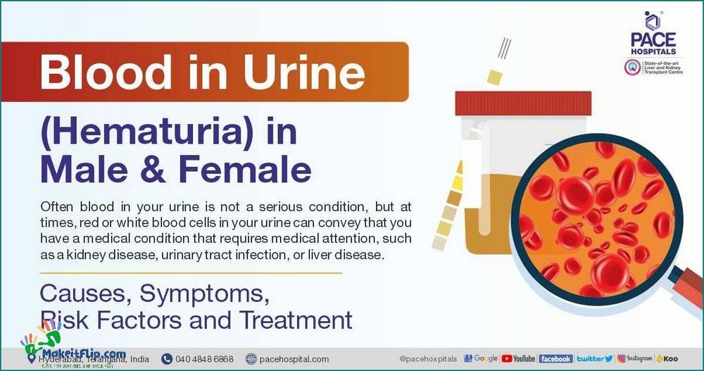 Blood in Urine During Pregnancy Causes Symptoms and Treatment