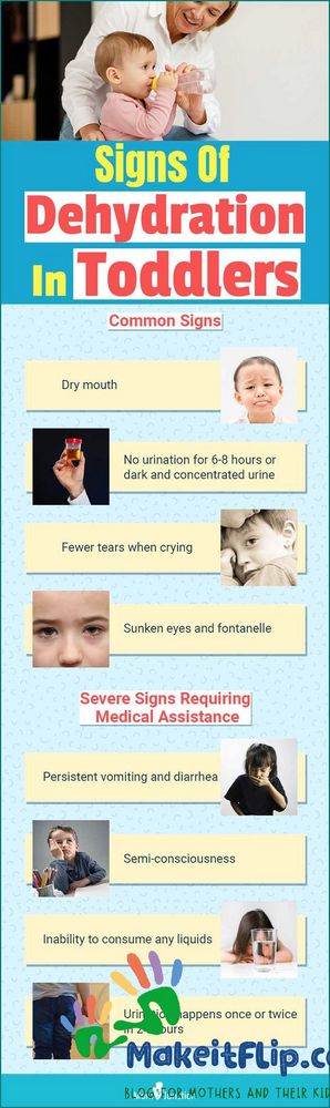 Sunken Eyes Dehydration Causes Symptoms and Treatment