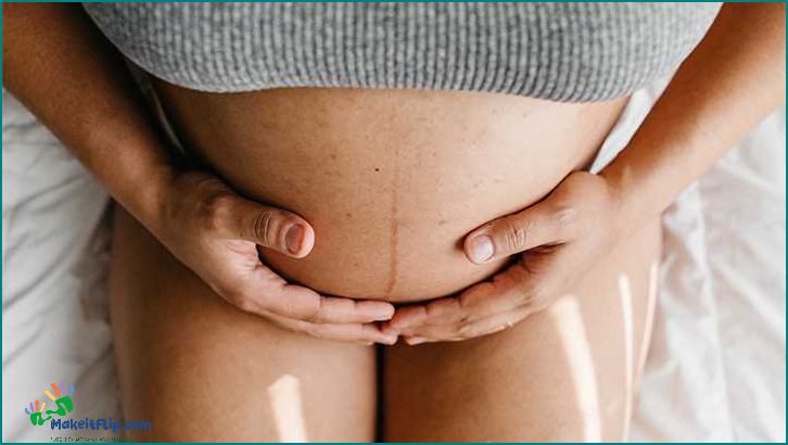How to Relieve an Itchy Pregnant Belly Tips and Remedies