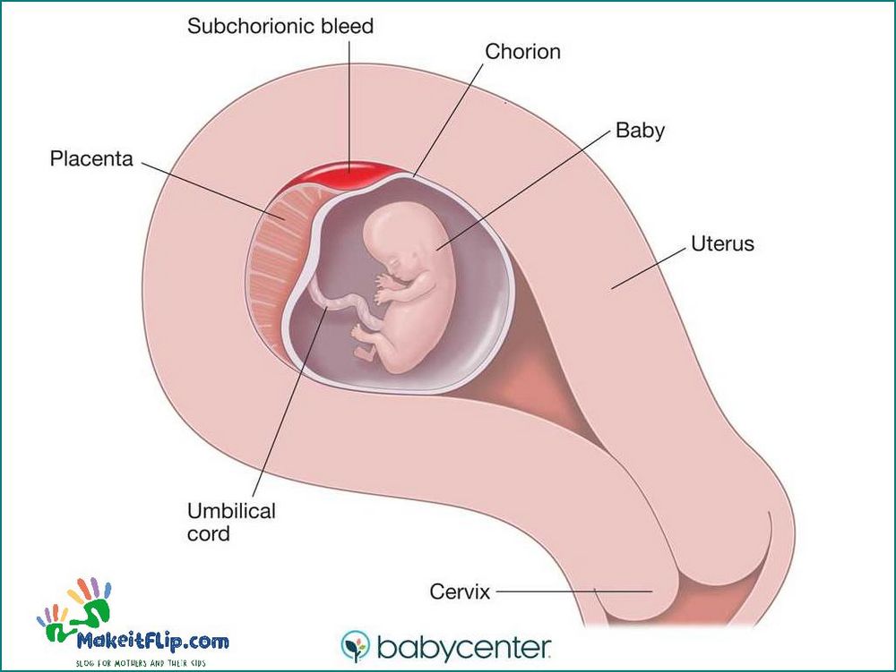 Sch Pregnancy Symptoms Risks and Treatment