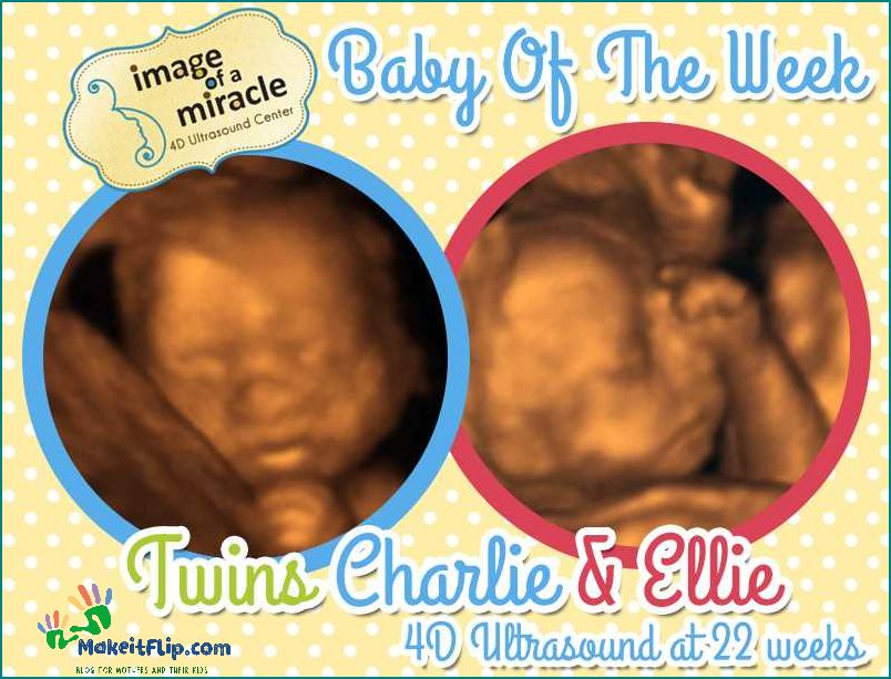 Ultrasound Pictures of Twins Capturing the Miracles of Multiple Blessings