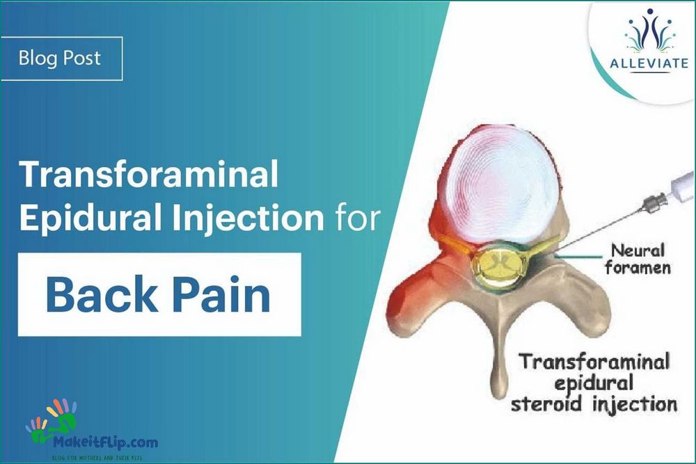Understanding and Managing Back Pain after Epidural Causes Symptoms and Treatment Options