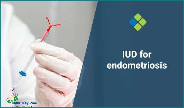 Understanding the Role of IUDs in Managing Endometriosis