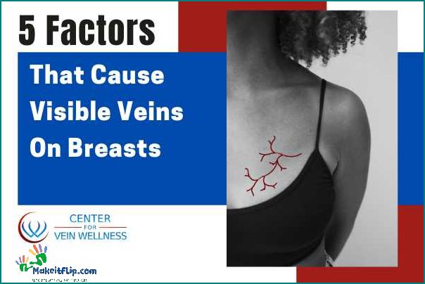 Understanding Veins in Breast Causes Symptoms and Treatment
