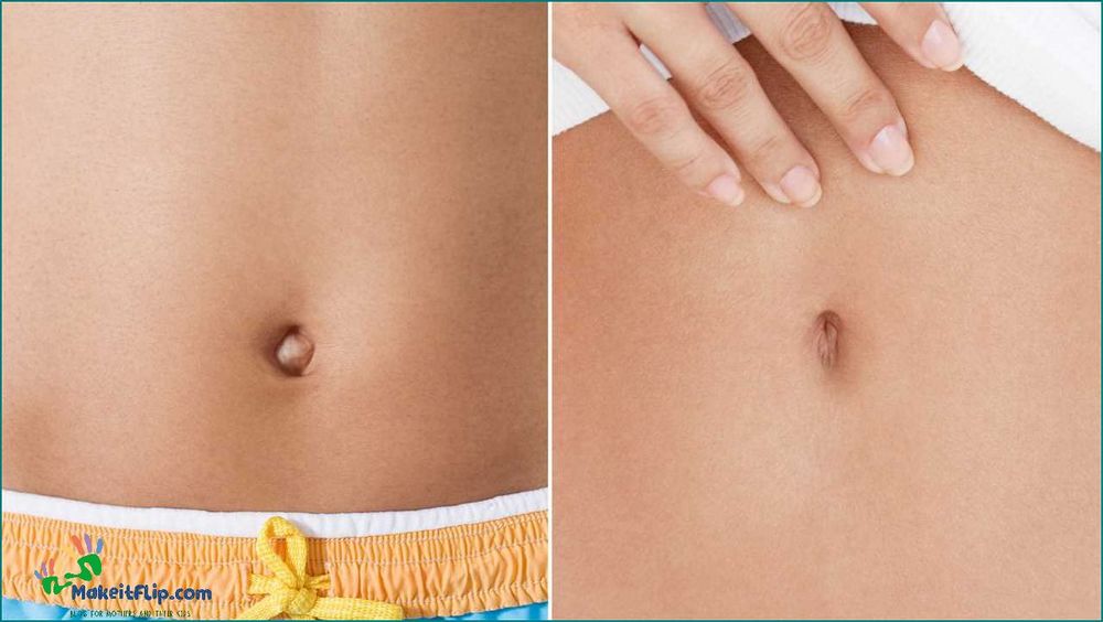 What is an Outie Belly Button and How to Deal with It